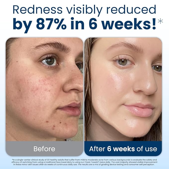 Clean Skin Club Clean Towels XL®